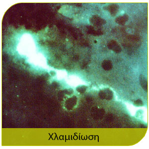 ασθένεις στον άνθρωπο από πτηνά και χλαμυδίωση